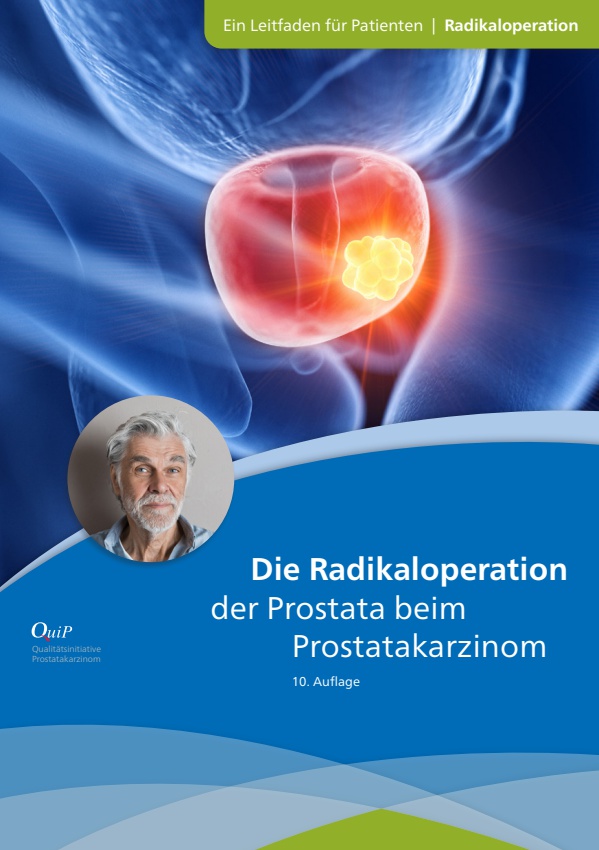 Die Radikaloperation der Prostata beim Prostatakarzinom (10. Auflage)