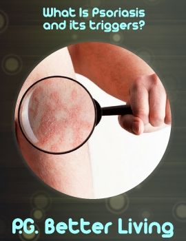 Psoriasis_Triggers