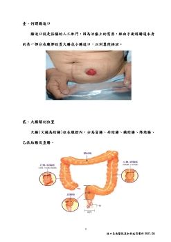 腸造口術後衛教手冊106.APA(1)_Neat