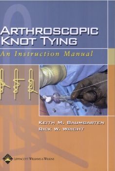 Arthroscopic Knot Tying