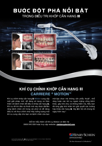Khí cụ chỉnh khớp Carriere Motion Hạng III