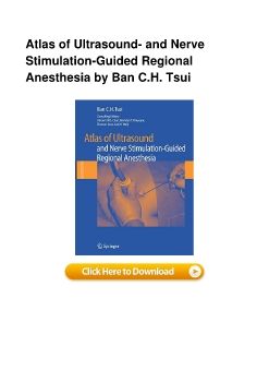 Atlas of Ultrasound- and Nerve Stimulation-Guided Regional Anesthesia by Ban C.H. Tsui