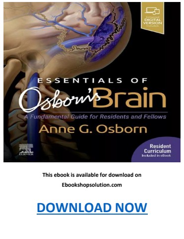 Essentials of Osborn’s Brain PDF