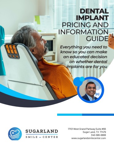 Sugarland Implant Pricing Guide