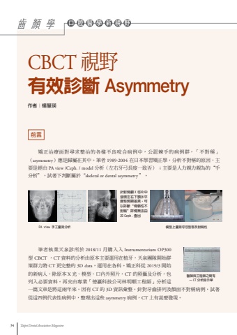 CT-Asymmetry
