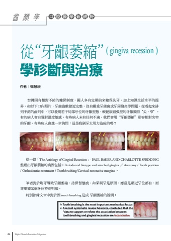 從牙齦萎縮學診斷與治療