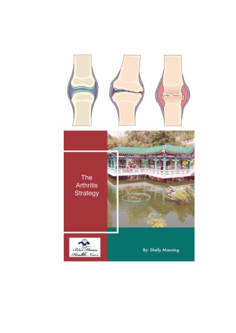 The Arthritis Strategy Program (Critical Customer Alert!) Is Shelly Manning’s Book Legit? PDF Download!