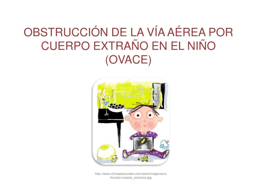 OBSTRUCCIÓN DE LA VÍA AÉREA POR CUERPO EXTRAÑO EN EL NIÑO  (OVACE)