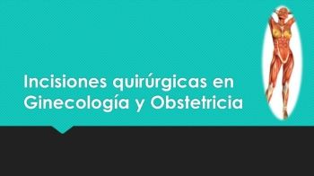 Incisiones quirúrgicas en Ginecología y Obstetricia