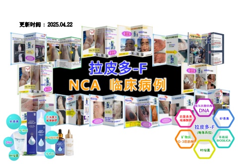 NCA 臨床事例