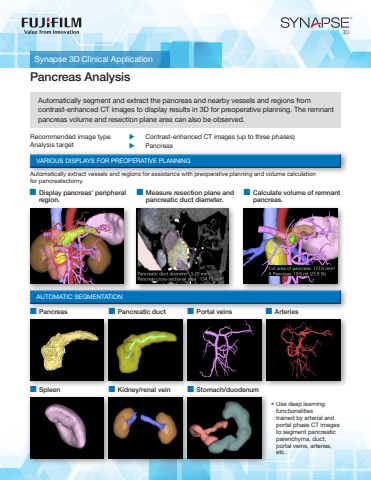 Synapse 3D Interative brochure