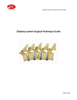 ZVplasty Surgical Technique Guide 2018