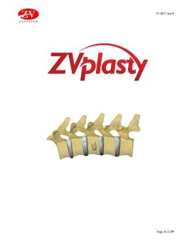ZVPlasty - Hensler Technique Guide 2021