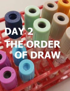 The Order Of Draw (DAY 2)