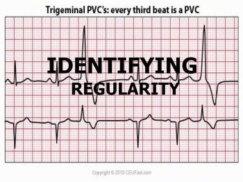 IDENTIFYING REGULARITY