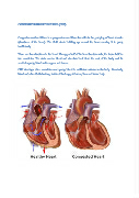 Congestive cardiac failure_Classical
