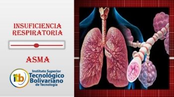 Insuficiencia Respiratoria