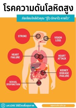 โรคความดันโลหิตสูง ภัยเงียบใกล้ตัวคุณ