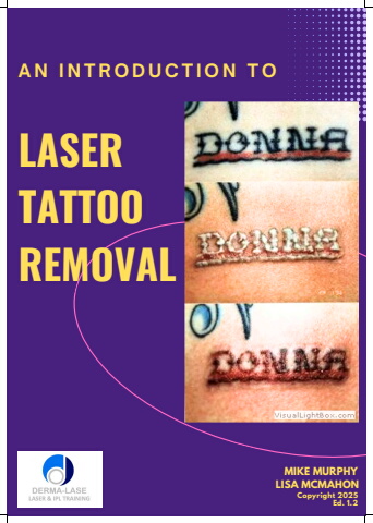 Laser Tattoo Removal