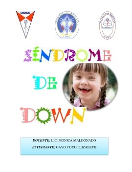 SINDROME DE DOWN