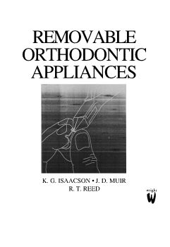 REMOVABLE ORTHODONTIC APPLIANCES