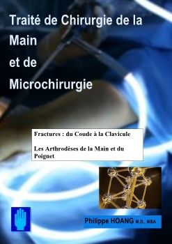 Fractures du coude et arthrodèsesl