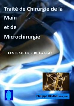 Fractures de la Main