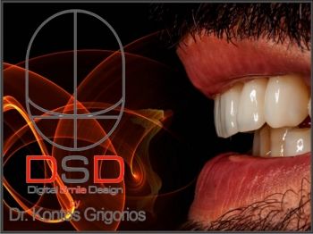 DIGITAL SMILE DESIGN  2