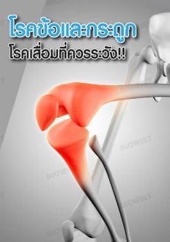 โรคข้อและกระดูก โรคเสื่อมที่ควรระวัง