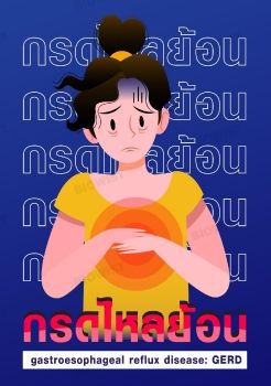 กรดไหลย้อน