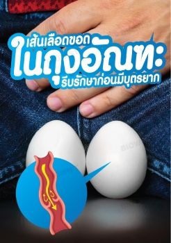เส้นเลือดขอดในถุงอัณฑะ รีบรักษาก่อนมีบุตรยาก