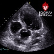 APICAL VIEW 5 CH
